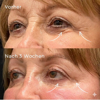 Retinol Eye GlowRoll