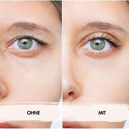 EyePerfect Anti-Schlufplider Tape
